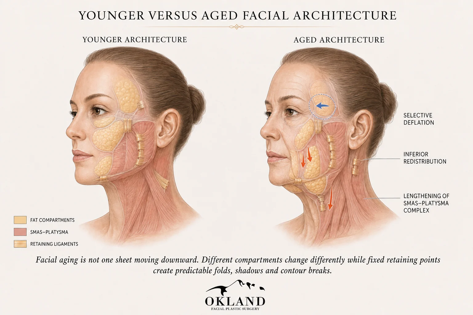 Medical illustration comparing younger and aged facial architecture.